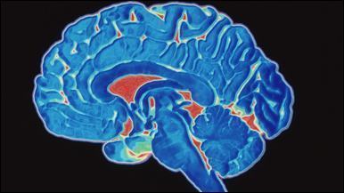 Depressão, depressão, Lutando contra a depressão, cuidados com a depressão, depressão o que é, sintomas de depressão